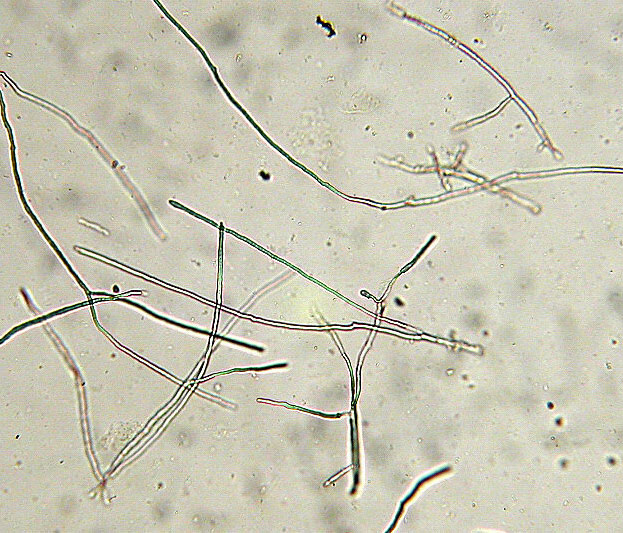 Hyphal fragments appeared in aqueous Czapek culture